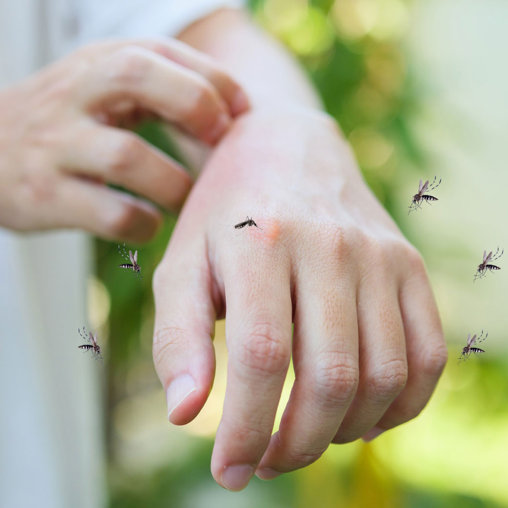 รู้ก่อนซื้อ ทำไมยุงลายหน้าฝน เป็นภัยร้ายต้องระวังเป็นพิเศษ